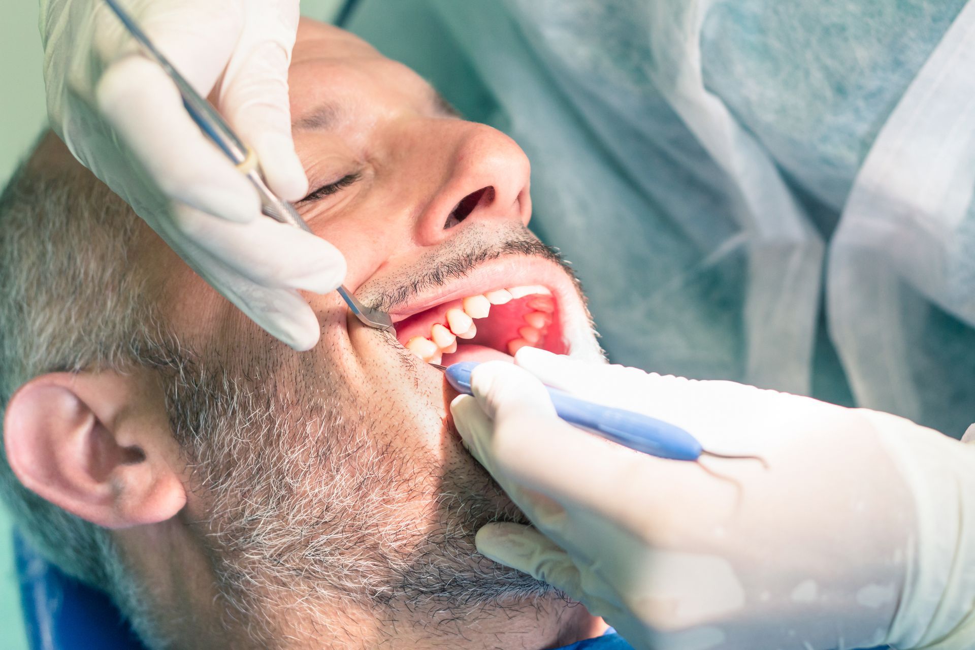 guy getting his mouth examined by dentist