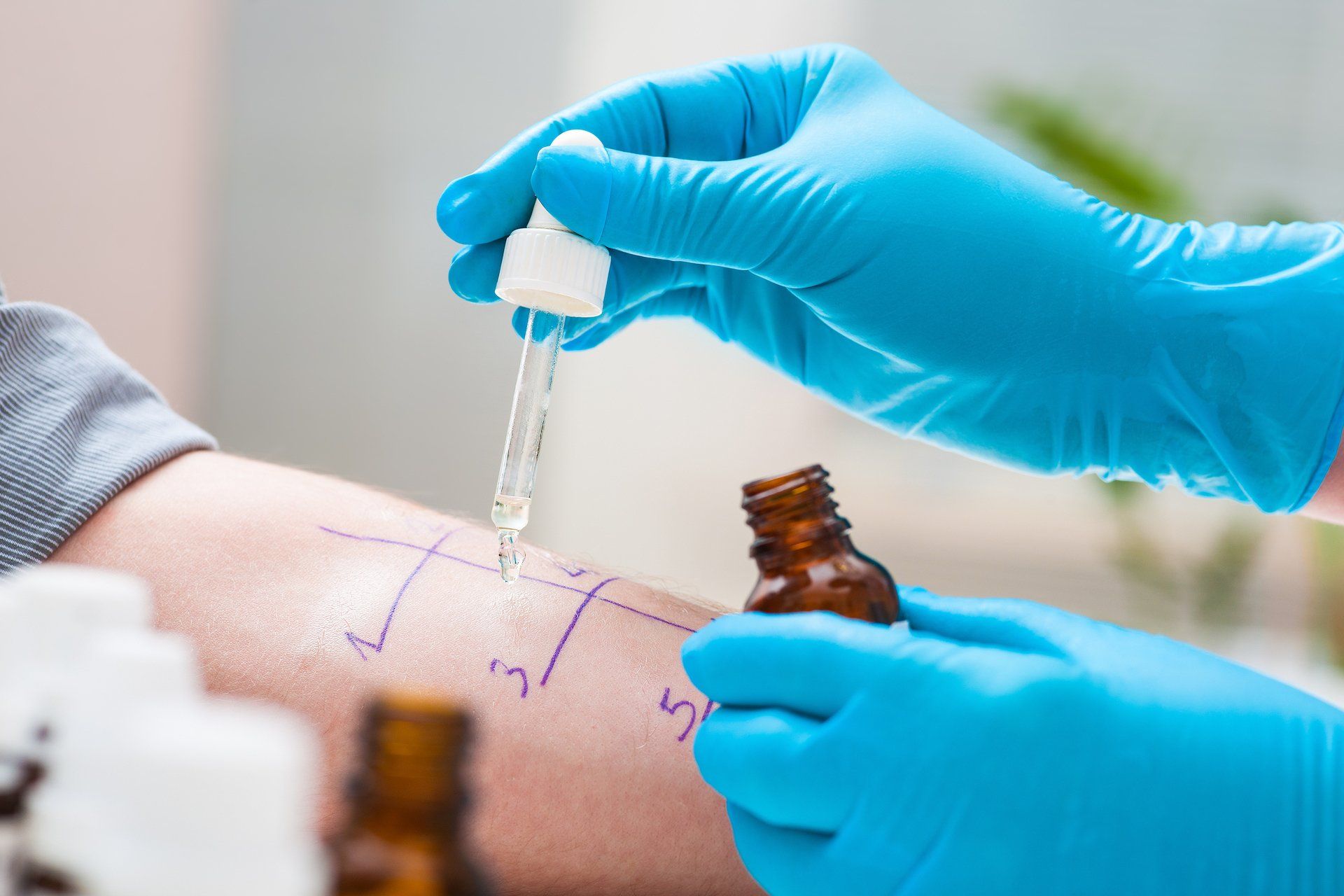 Gold Coast Allergy Testing | Allergy First