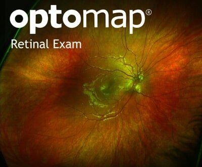 OptoMap Retinal Exam — Eyeglasses in Corpus Christi, TX