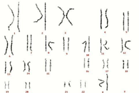 Il cariotipo su sangue
