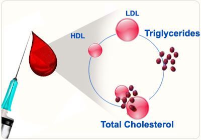 A diagram of triglycerides , ldl , and total cholesterol.