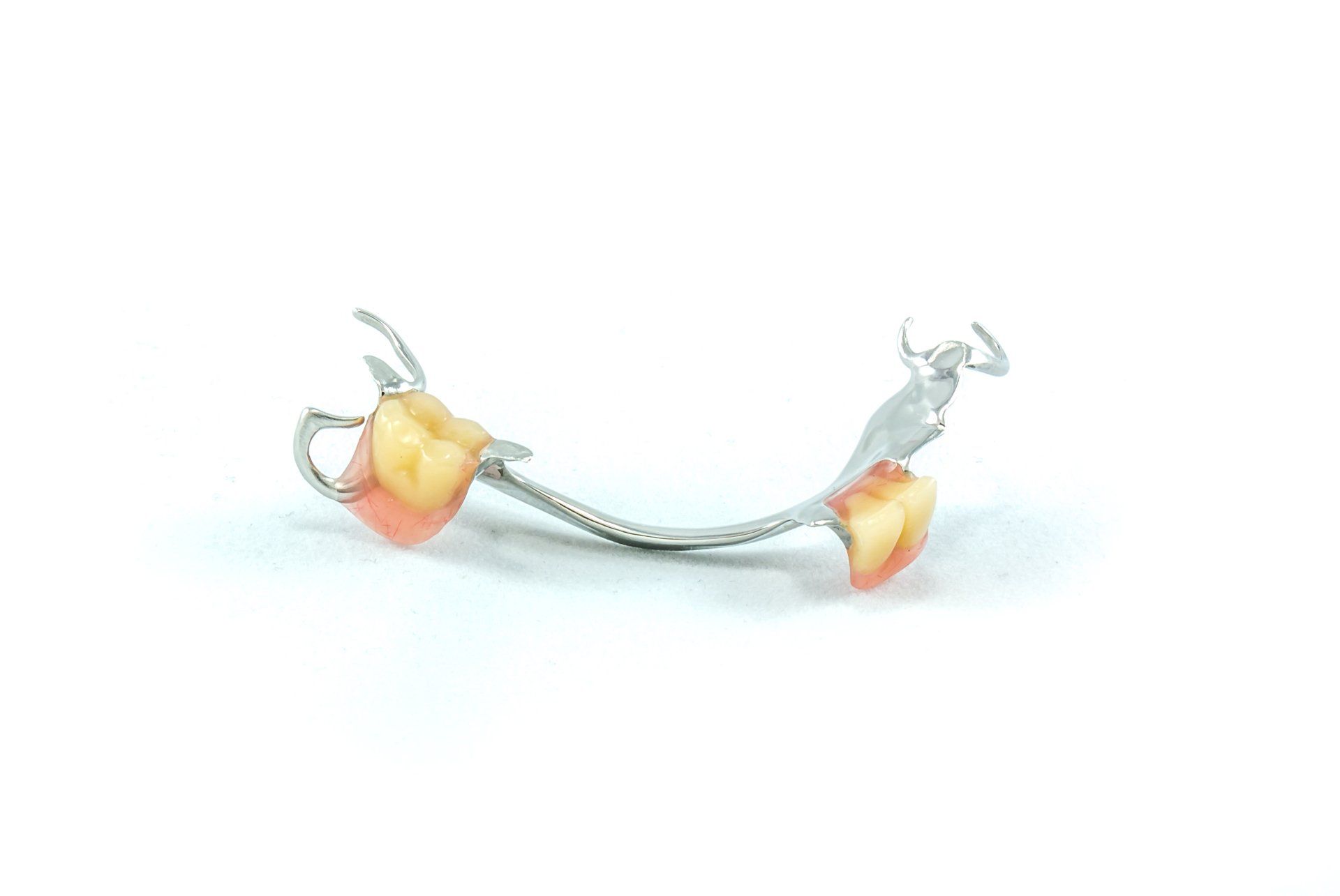Dental Cast With Metal Framework For Partial Denture - Mosman, NSW - Mosman Denture Clinic