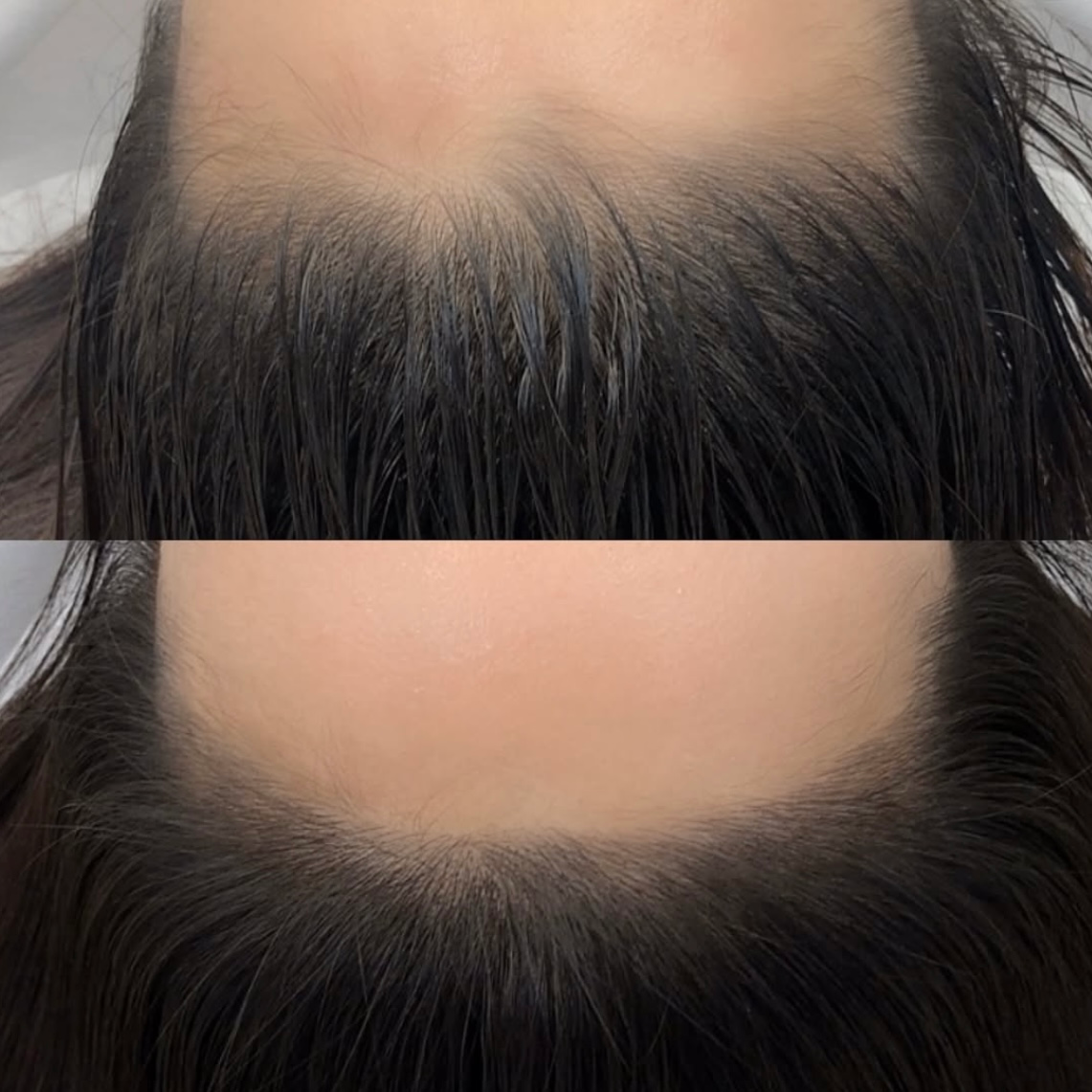 Woman wearing a white face mask, brown eyes, and dark eyebrows, lying down.