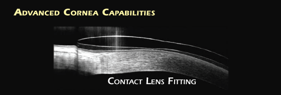 Tomografia a coerenza ottica