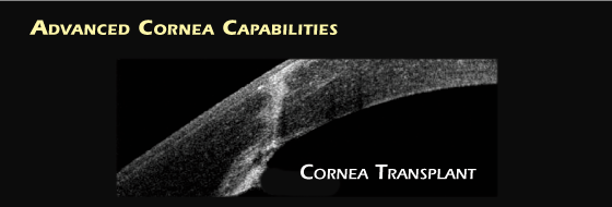 Tomografia a coerenza ottica