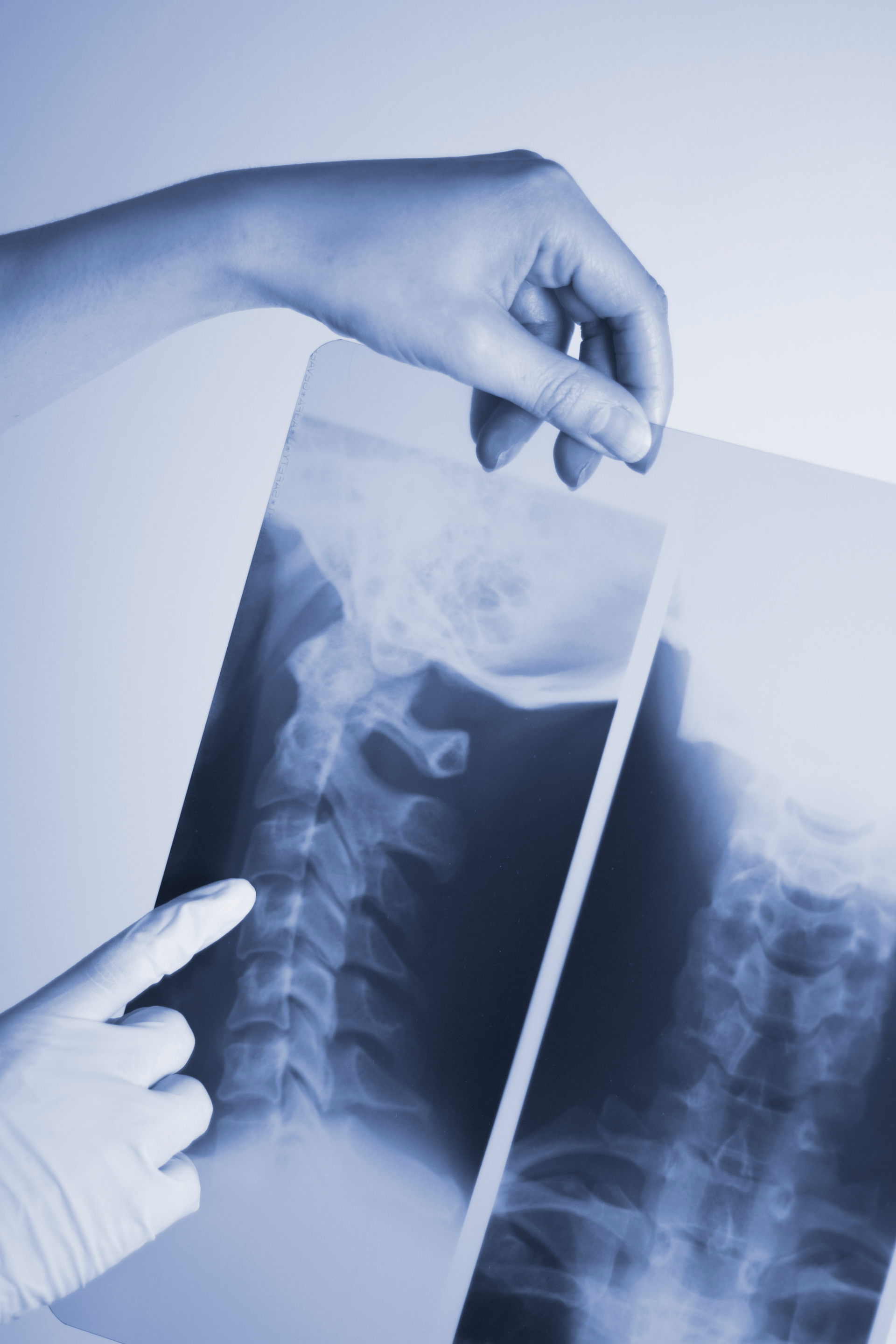 OSL xray badges