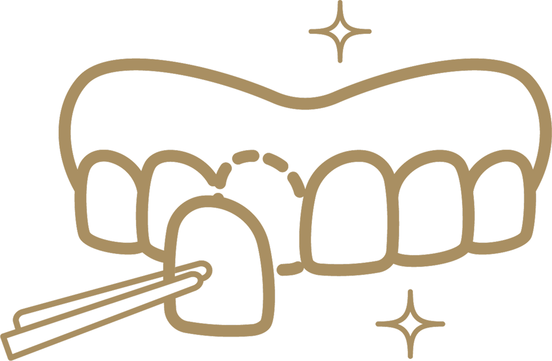 黃琮勛醫師 美容牙科｜頂級陶瓷貼片｜微笑設計｜全瓷貼片｜全瓷冠