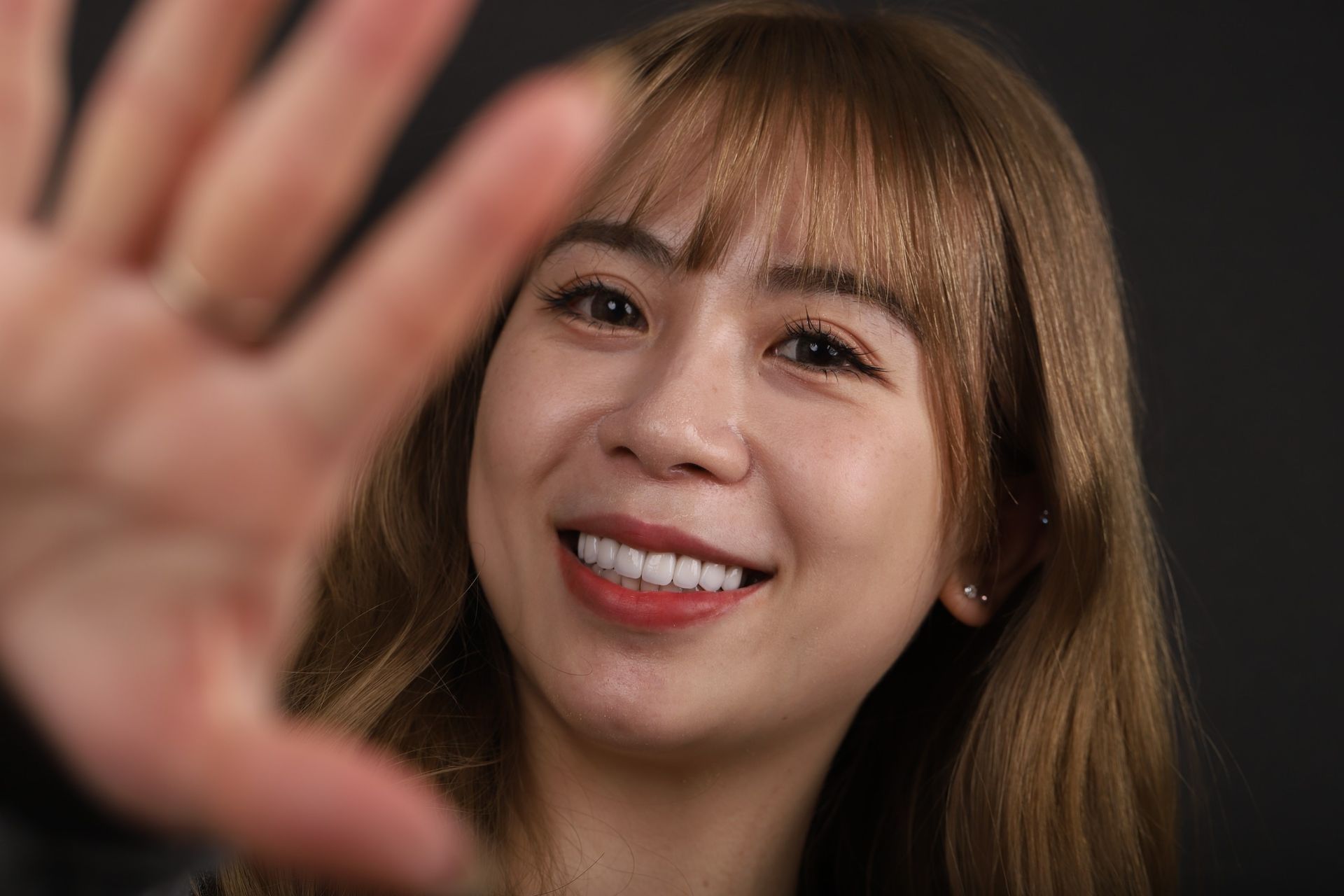 找回自信笑容的另一種選擇｜Ms. Chang｜黃琮勛醫師 美容牙科｜頂級陶瓷貼片｜微笑設計