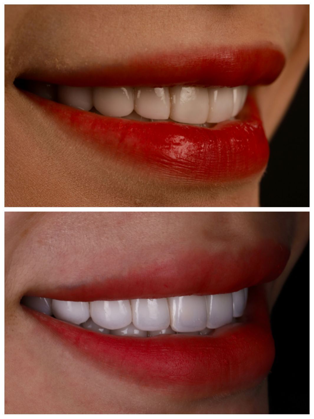 我就是我 每個人都是獨立個體｜全方位藝人 詩亞｜黃琮勛醫師 美容牙科｜頂級陶瓷貼片｜微笑設計