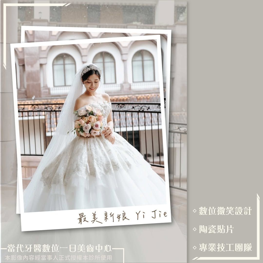 黃琮勛醫師 美容牙科｜頂級陶瓷貼片｜微笑設計自信笑容是婚禮的最美妝容｜最美新娘 Yi Jie