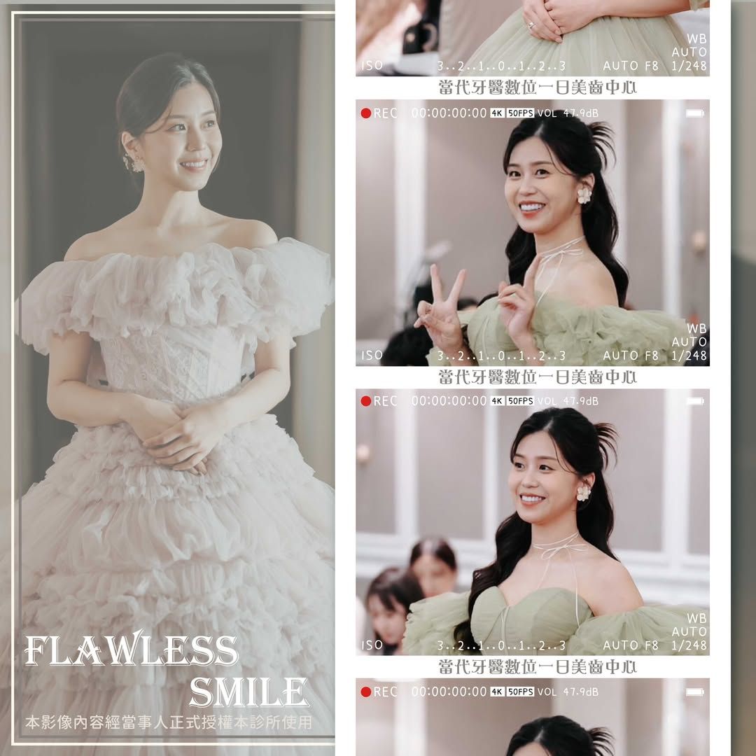 黃琮勛醫師 美容牙科｜頂級陶瓷貼片｜微笑設計自信笑容是婚禮的最美妝容｜最美新娘 Yi Jie