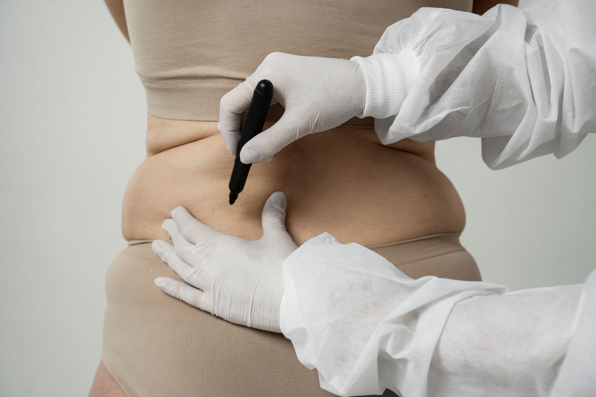 A doctor is marking a woman 's back with a marker.