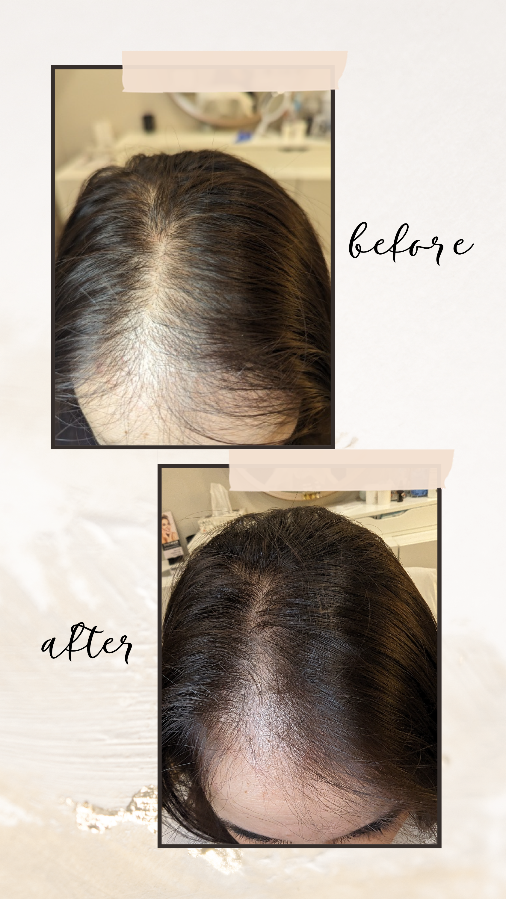 A before and after photo of a woman 's hair growth.