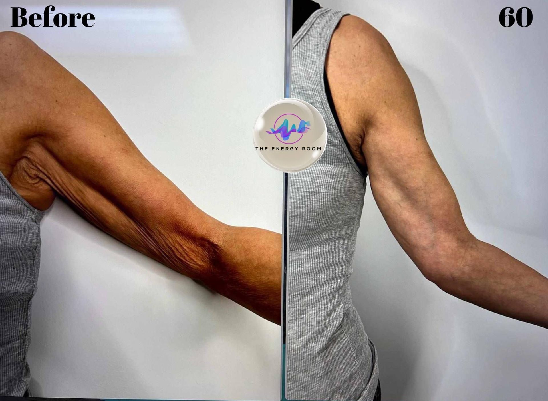 A before and after photo of a woman 's arms