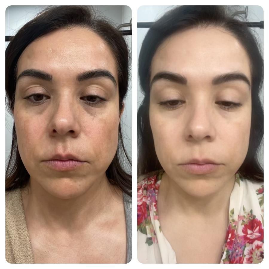 A before and after photo of a woman 's face.