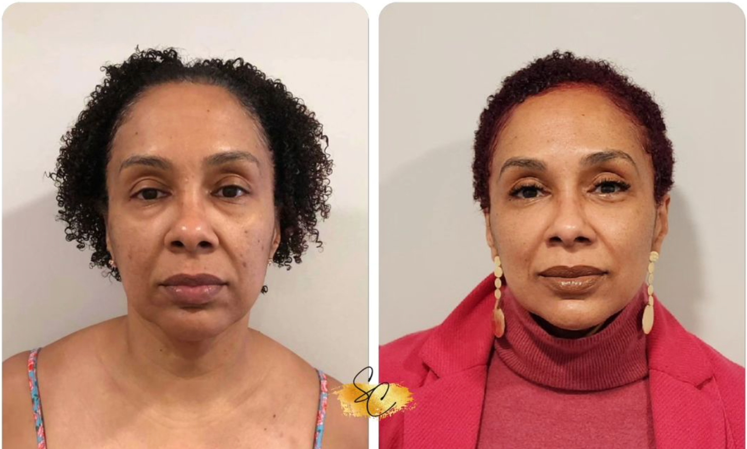 A before and after photo of a woman 's face.