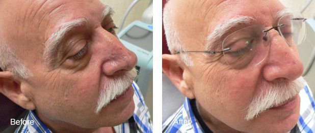 A man with a mustache and glasses is sitting in a chair.