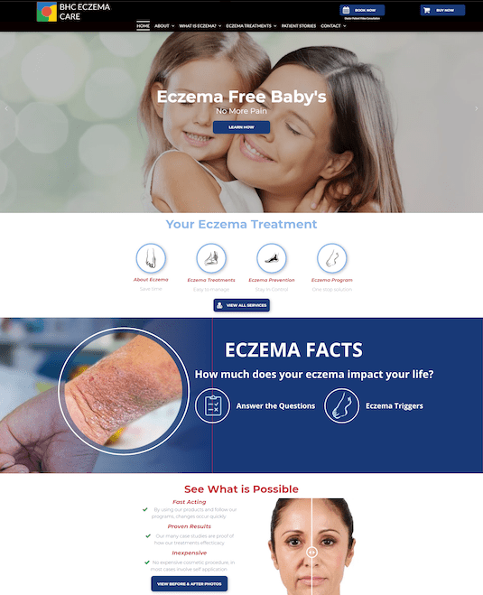 A screenshot of the eczema free baby 's website.