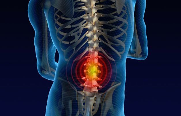 illustration of back pain