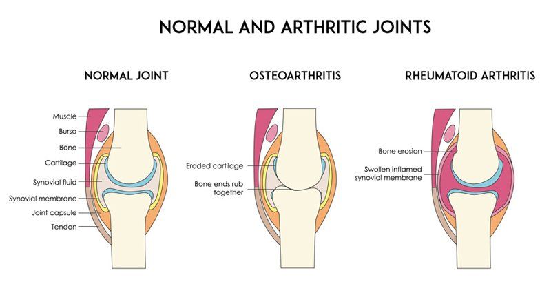 illustration of joints