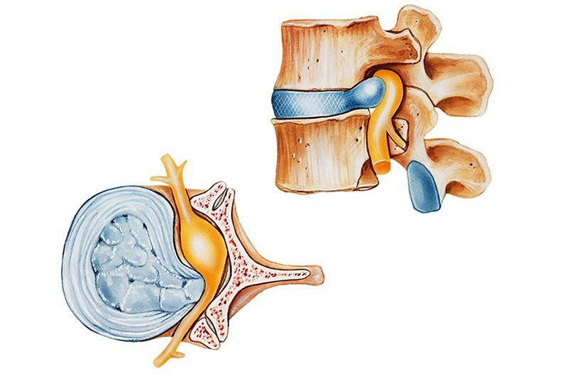 drawing of spine pieces