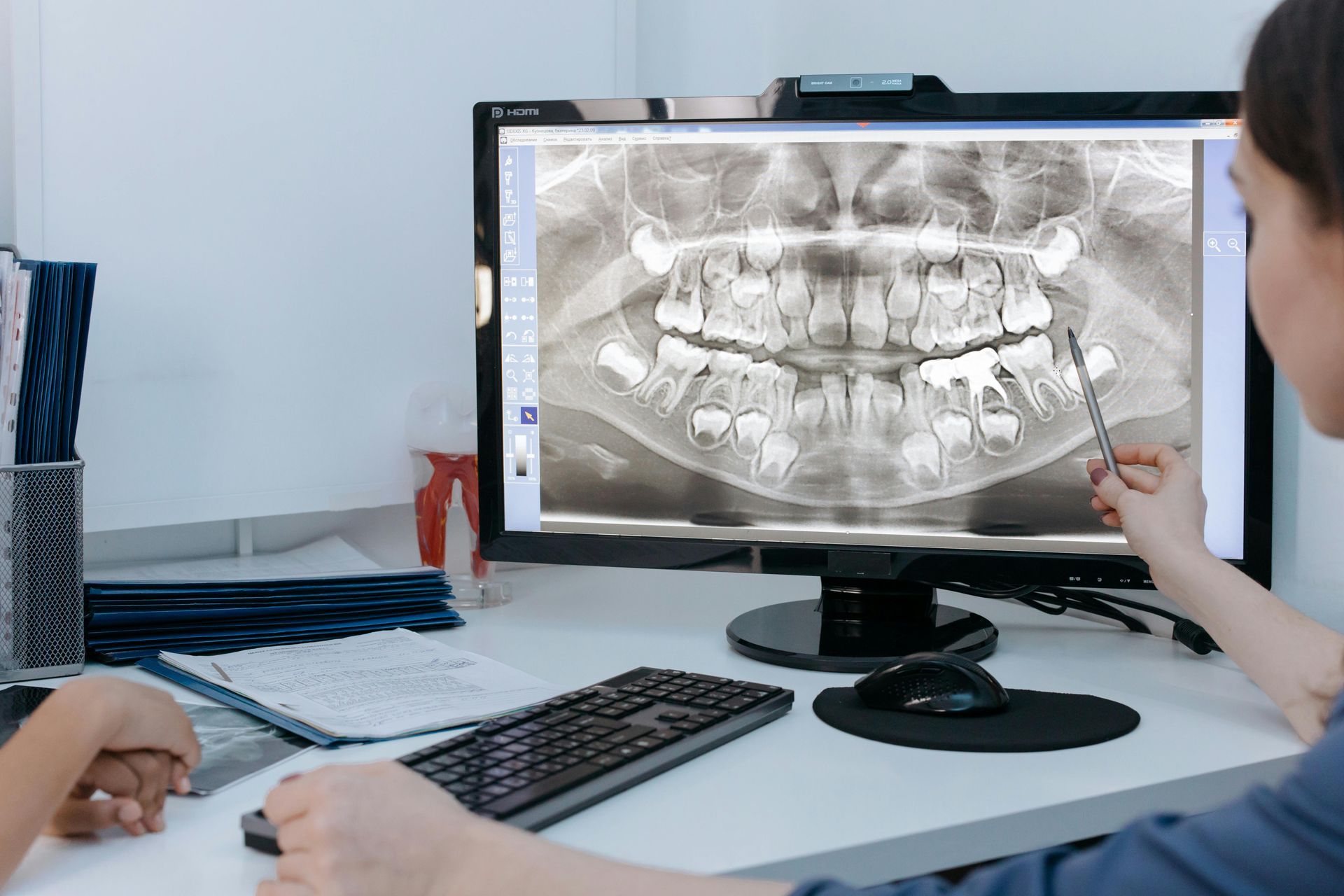 digital x-ray at dental office in Babylon NY during check up