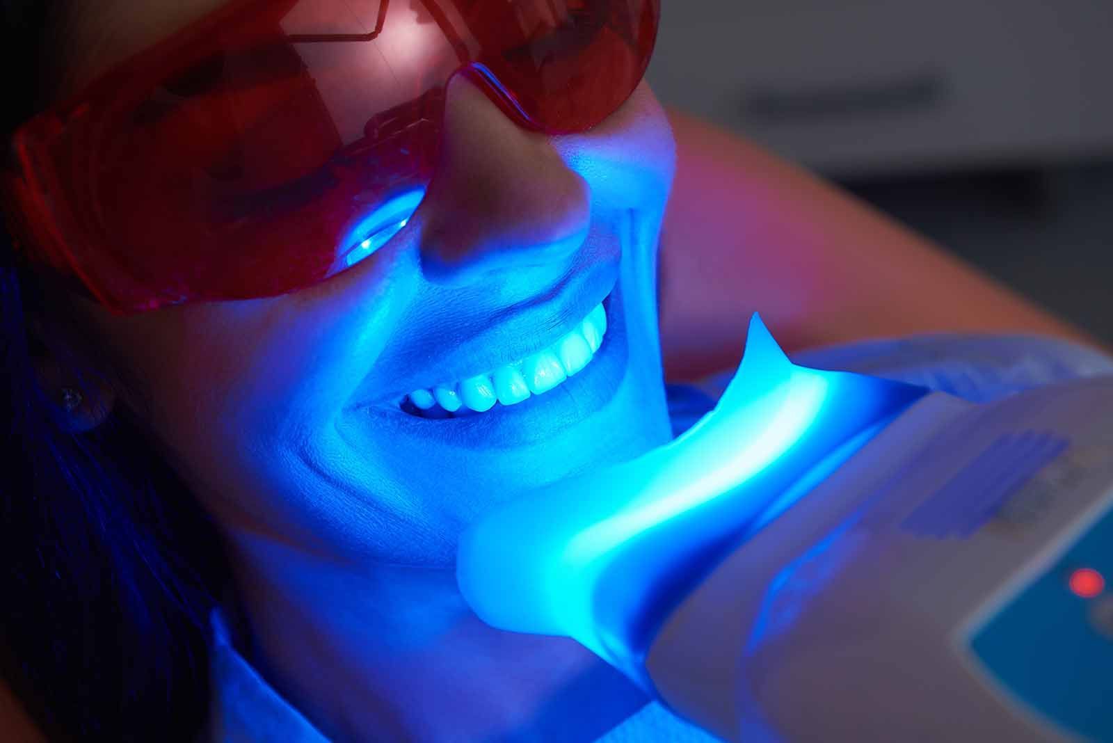 zoom office whitening procedure in Babylon NY dental office