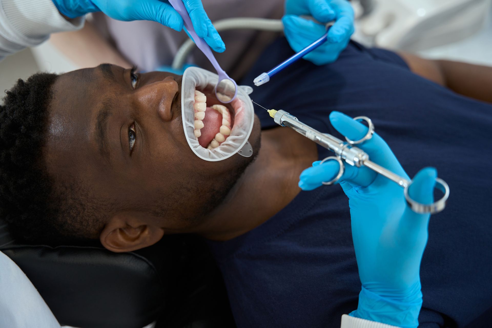 African American man receiving dental treatment with wide-open mouth, showing the process of dental examination or procedure.