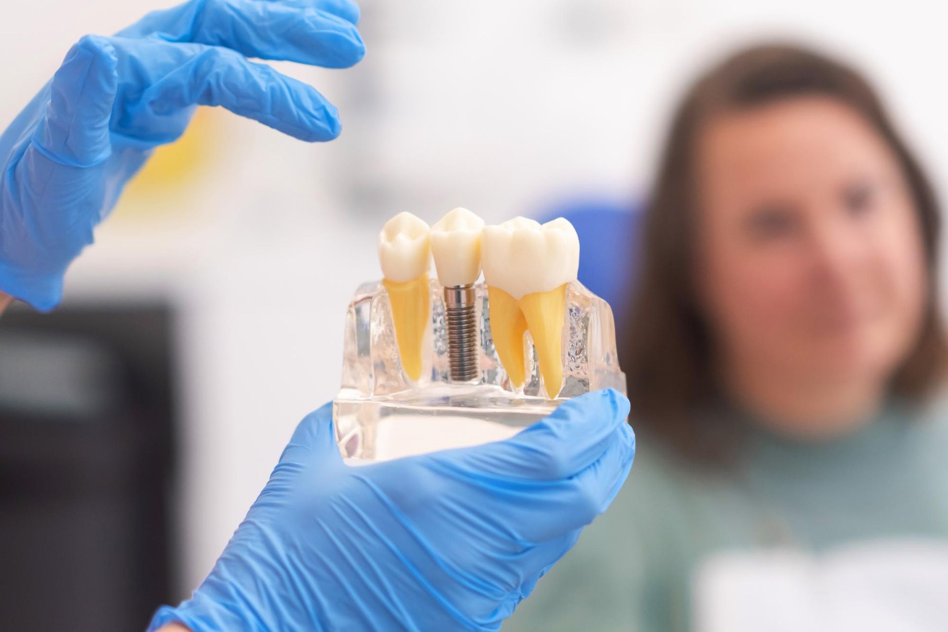 A dentist is holding a model of dental implants in front of a woman.