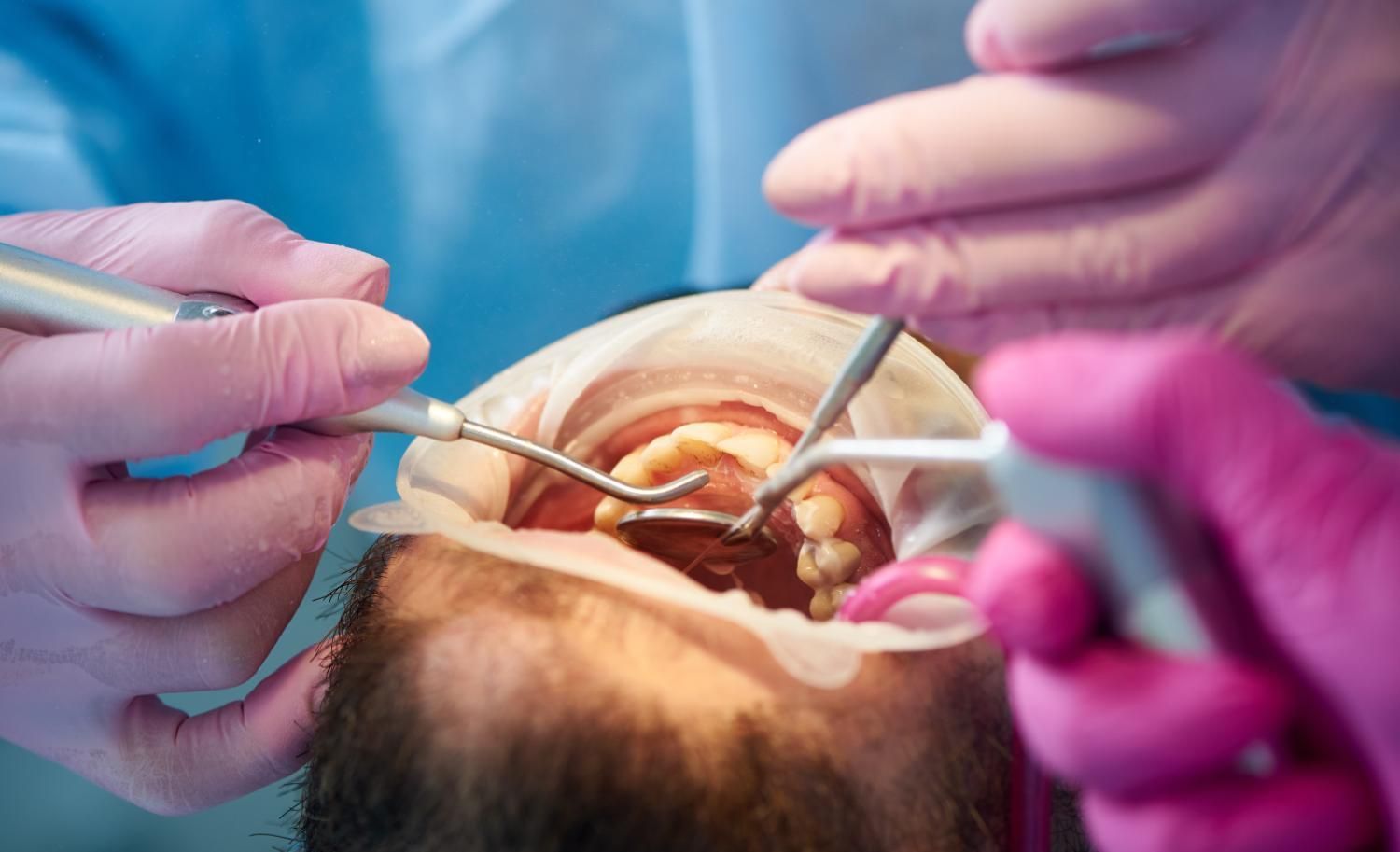 A dentist is examining a patient 's teeth in a dental office.