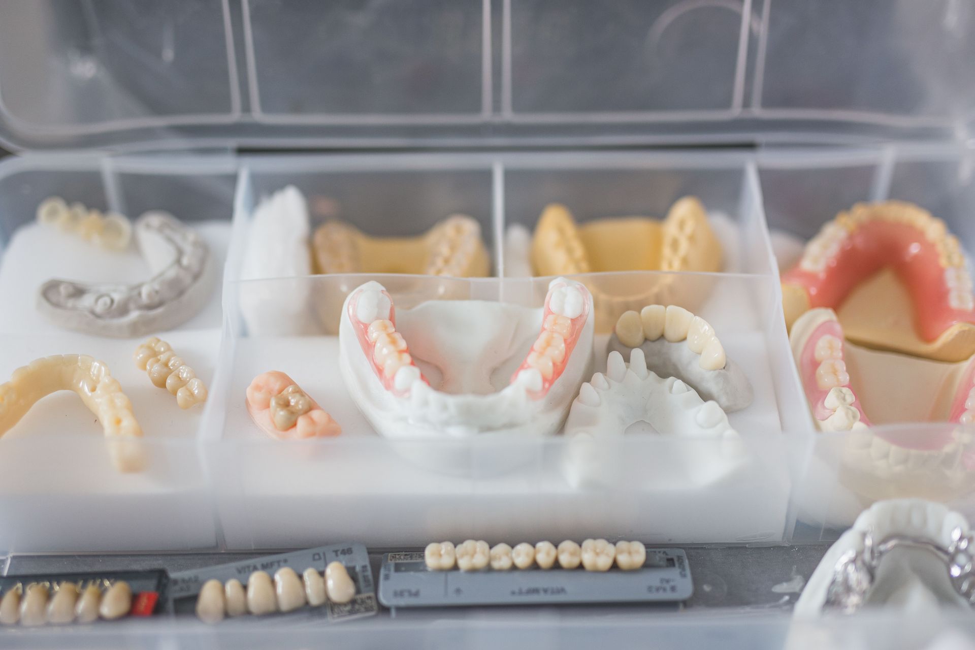 Close-up of various dental prostheses including partial dentures and bridges in a dental office, showcasing options for tooth replacement.