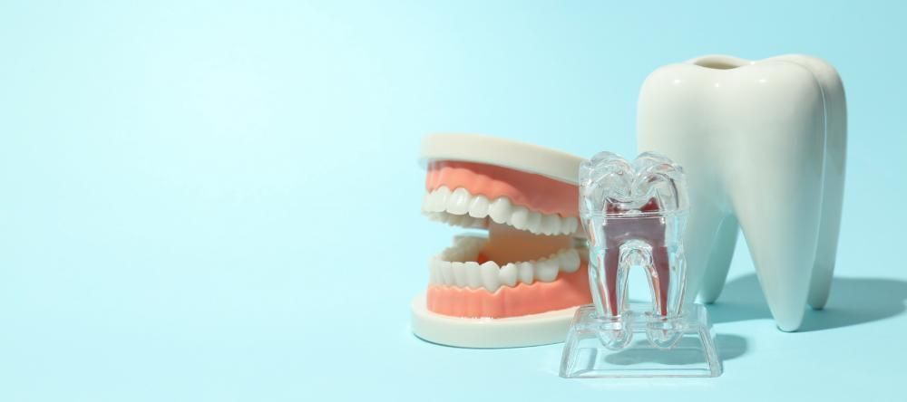 Benefits of Whole Mouth Tooth Implants