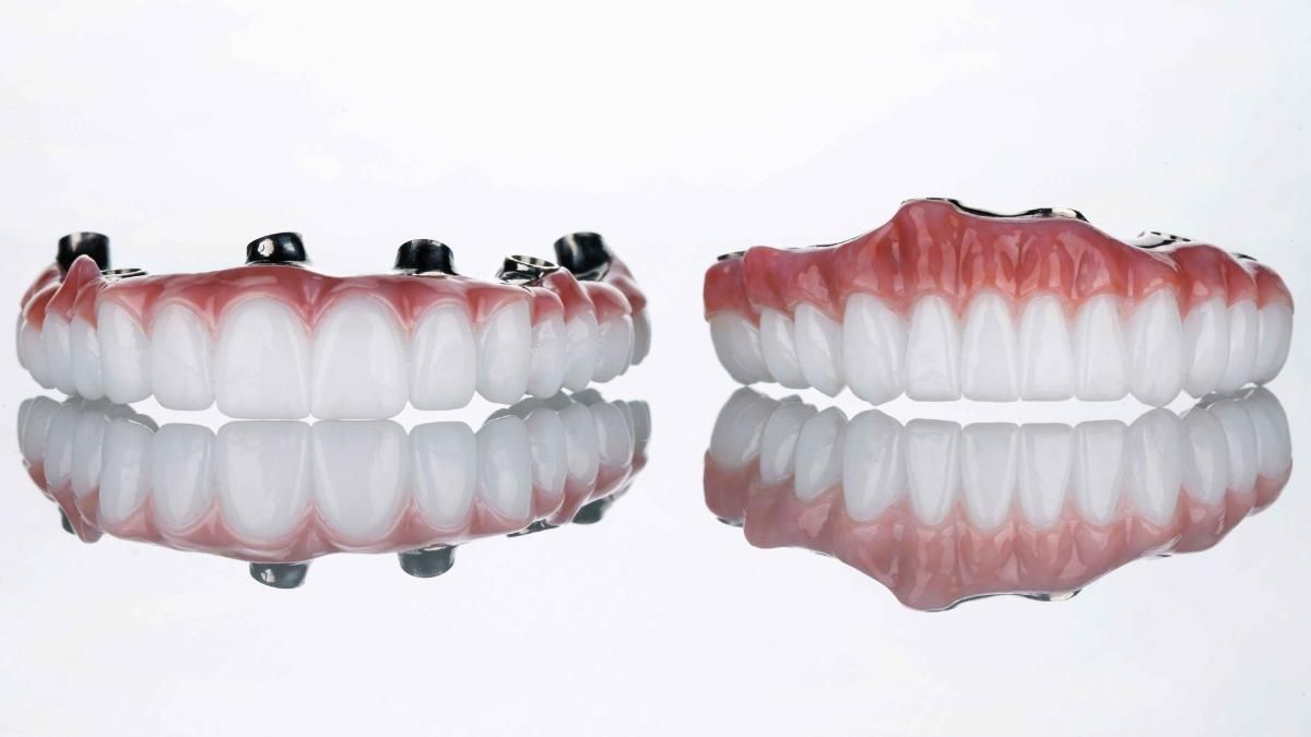 A close up of snap in false teeth on a white background