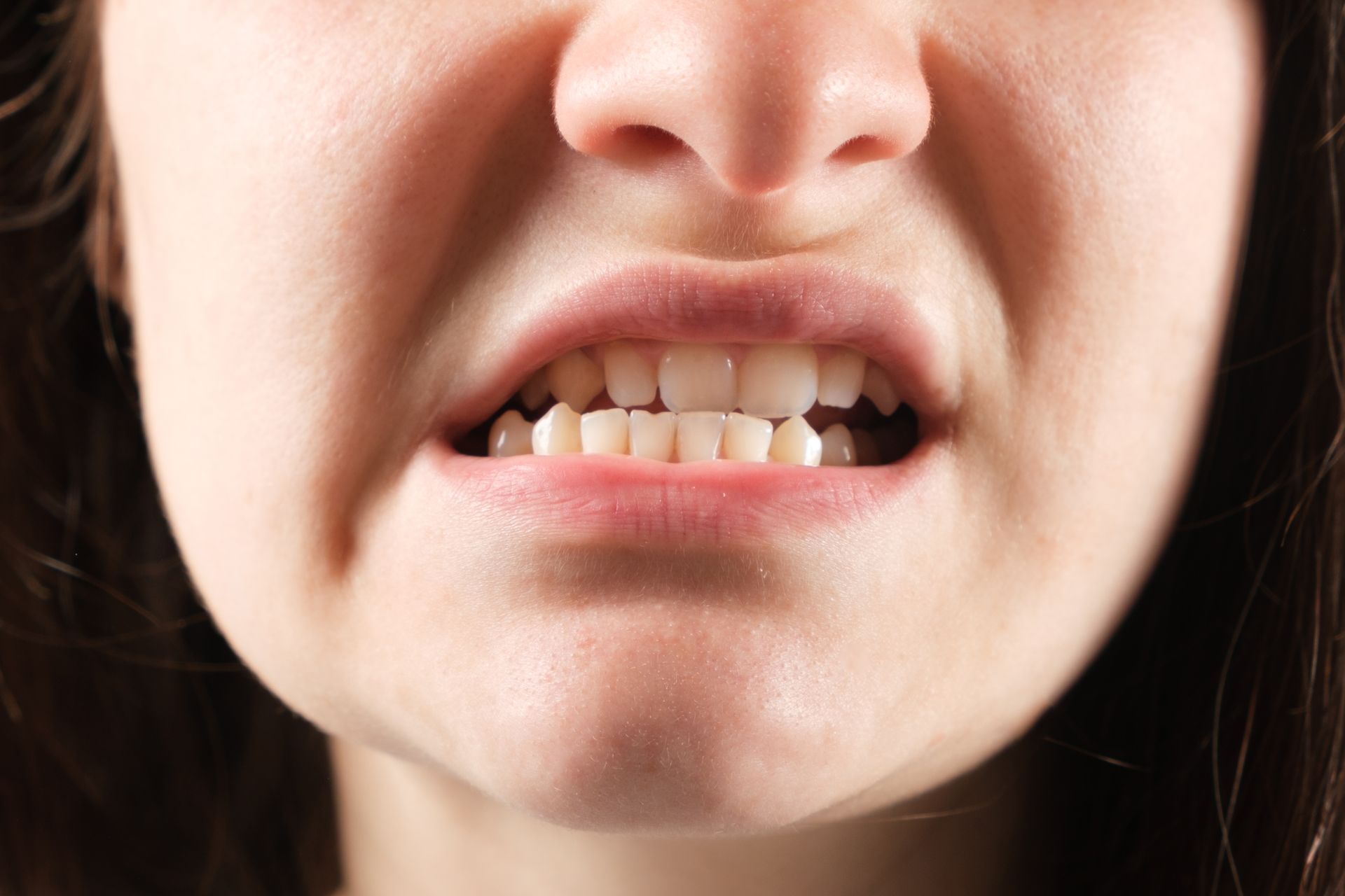 A close up of a woman 's mouth with her teeth showing.