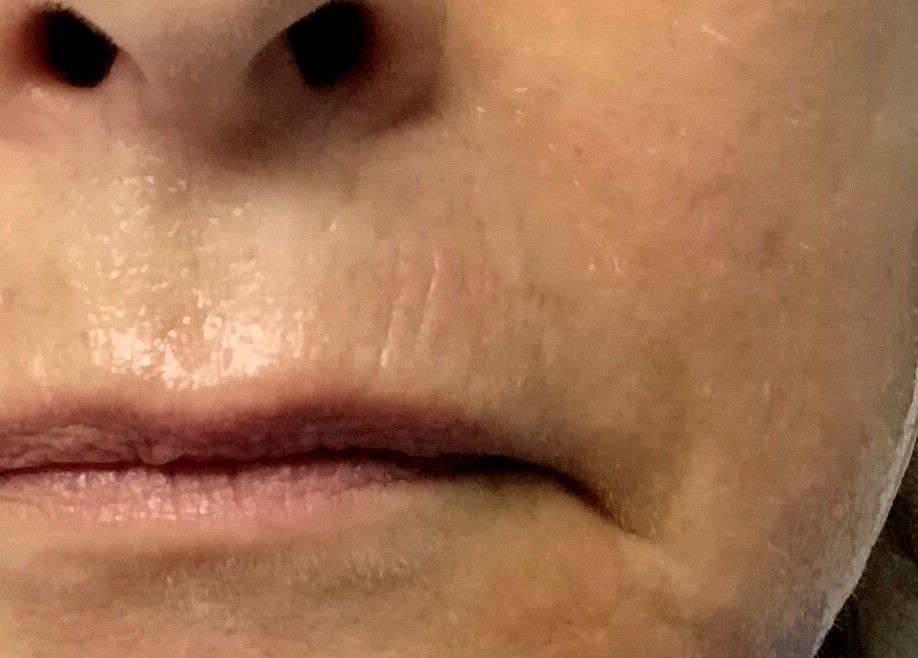 Close-up of a person's lower face, showing the nose, mouth, and skin with fine lines.