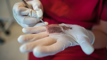 A person wearing white gloves is holding a needle in their hand.
