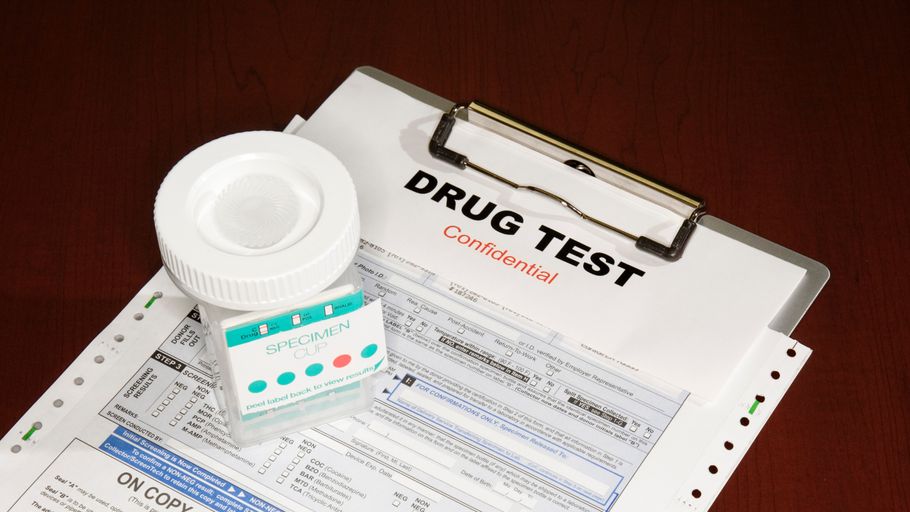 A bottle of pills is sitting on top of a drug test form.