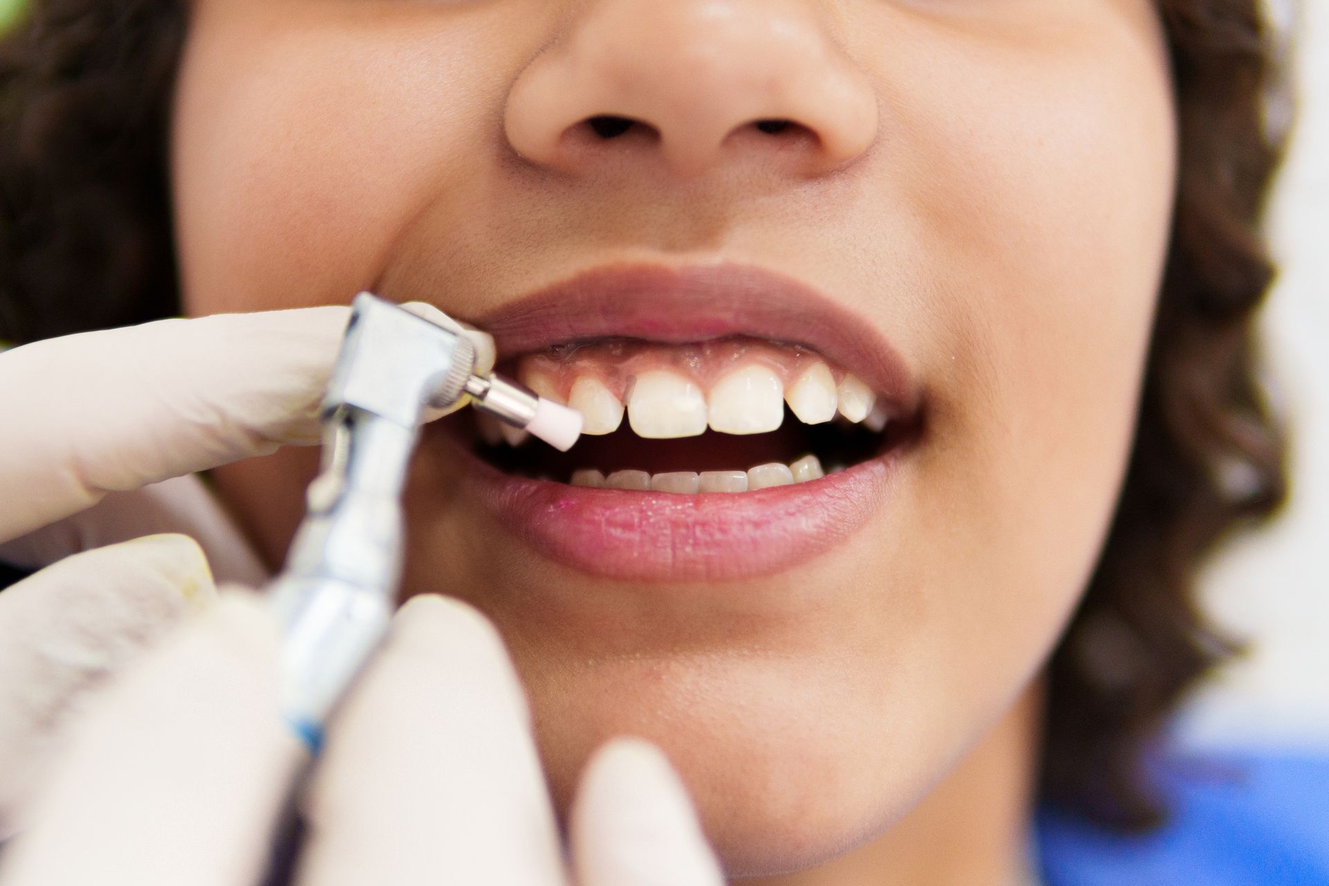 Dentist polishing a person's teeth, close-up. Person's mouth open, revealing white teeth; dentist's gloved hand holding tool.