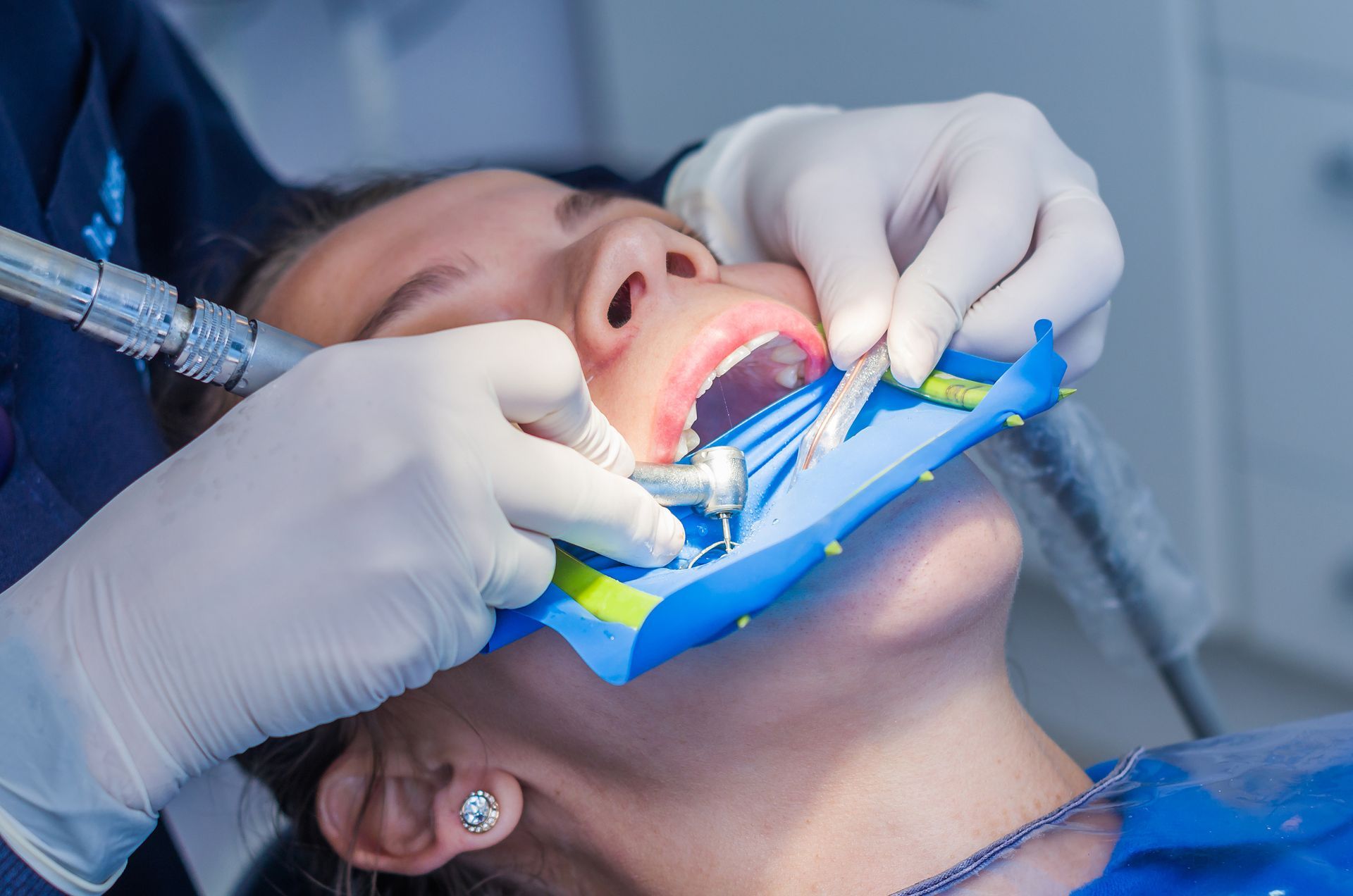 Dentist working on a patient's teeth; using tools and a rubber dam in a dental office.