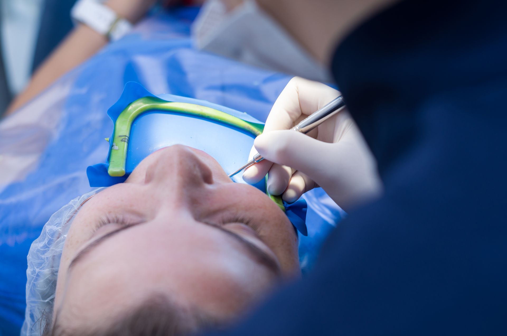 Surgeon performing a procedure on a patient's face; blue draping, closed eyes, surgical tools.