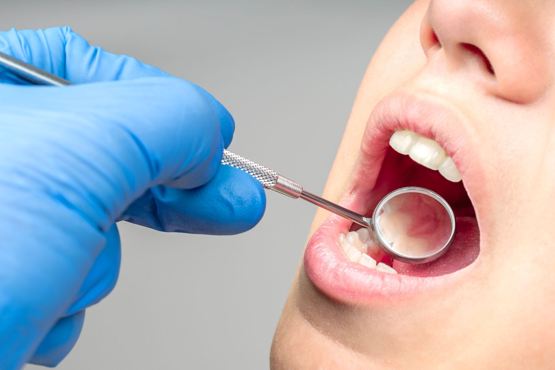 Dentist's gloved hand holding a mirror inside a patient's open mouth, examining teeth; close-up.