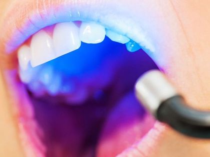 A woman is getting her teeth whitened with a blue light.