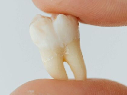 A woman is holding a tooth in her hand.