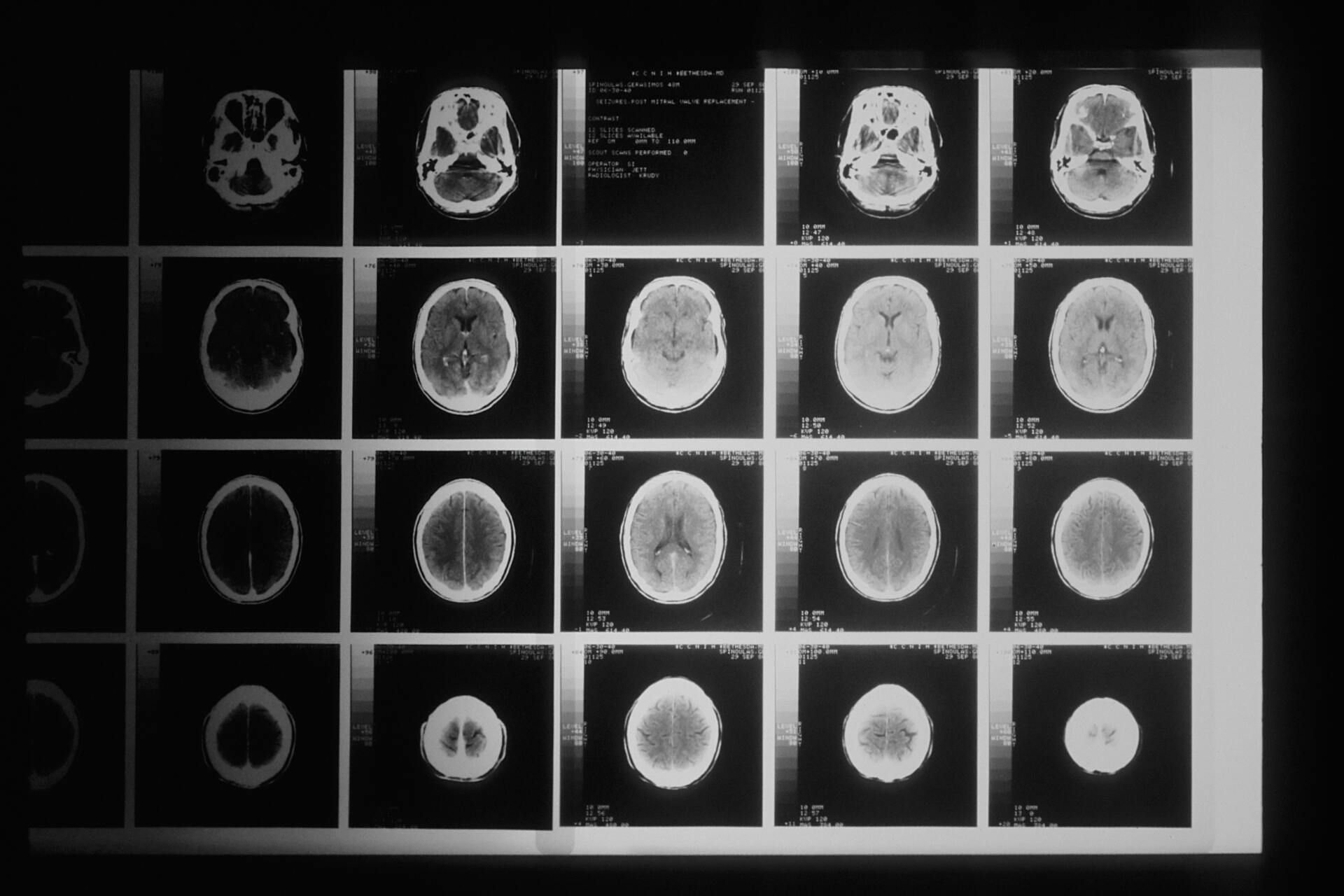 Neurocirurgião em São Cristóvão