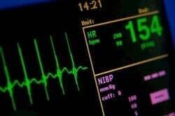 DR. DINO LAURO LÓPEZ MEDRANO - Presión arterial