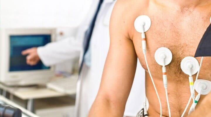 DR. DINO LAURO LÓPEZ MEDRANO - Prueba de esfuerzo