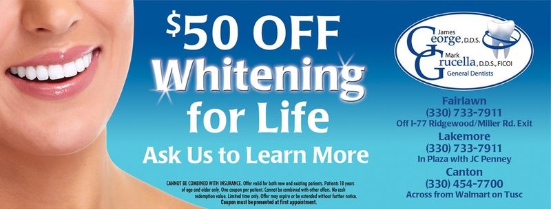 Coupon Teeth Whitening 50 OFF Whitening for Life