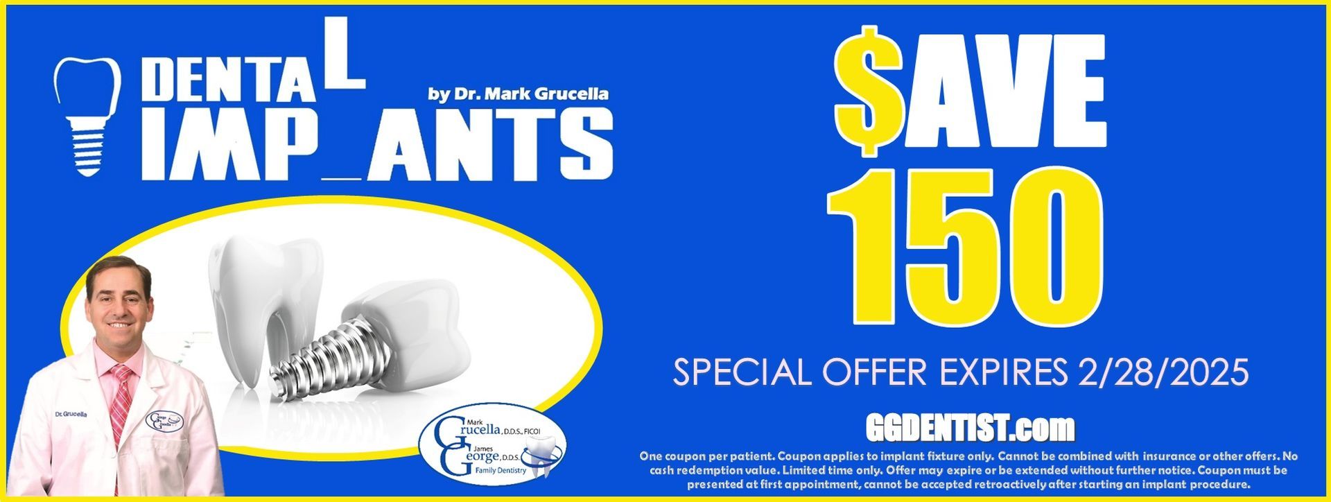 Dental Implant Coupon Save 150