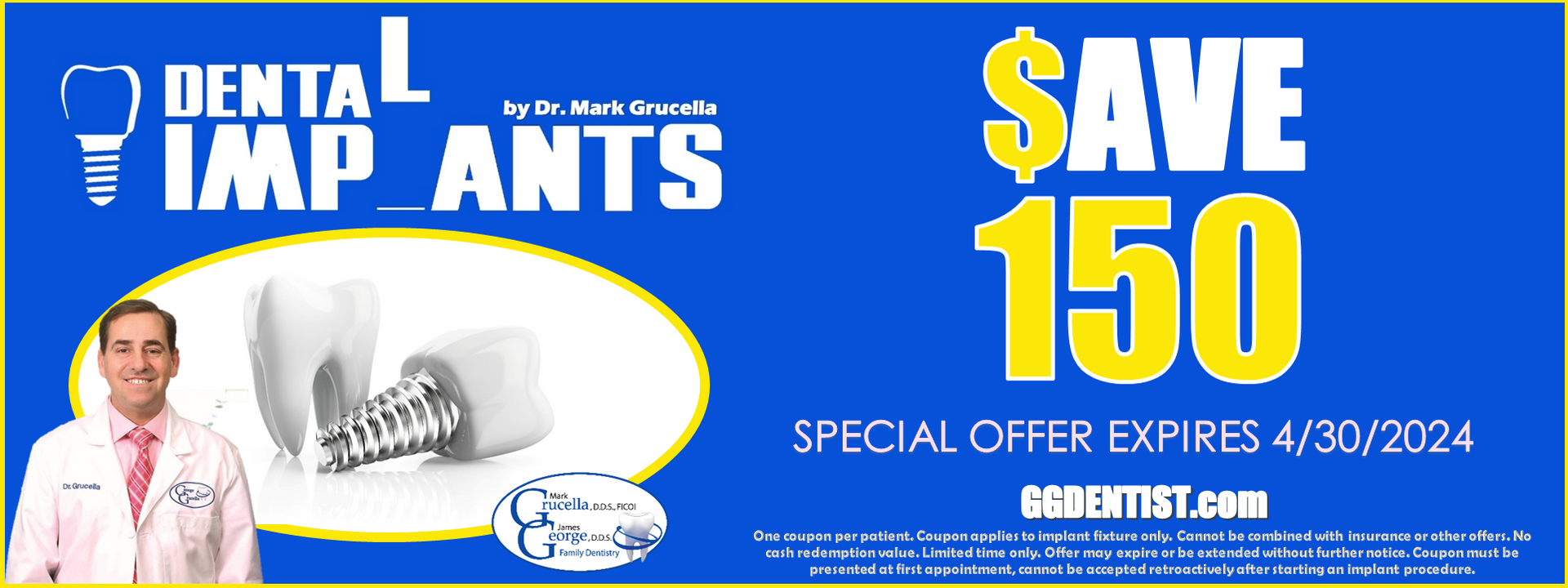 Dental Implant Special Offer Coupon Save 150