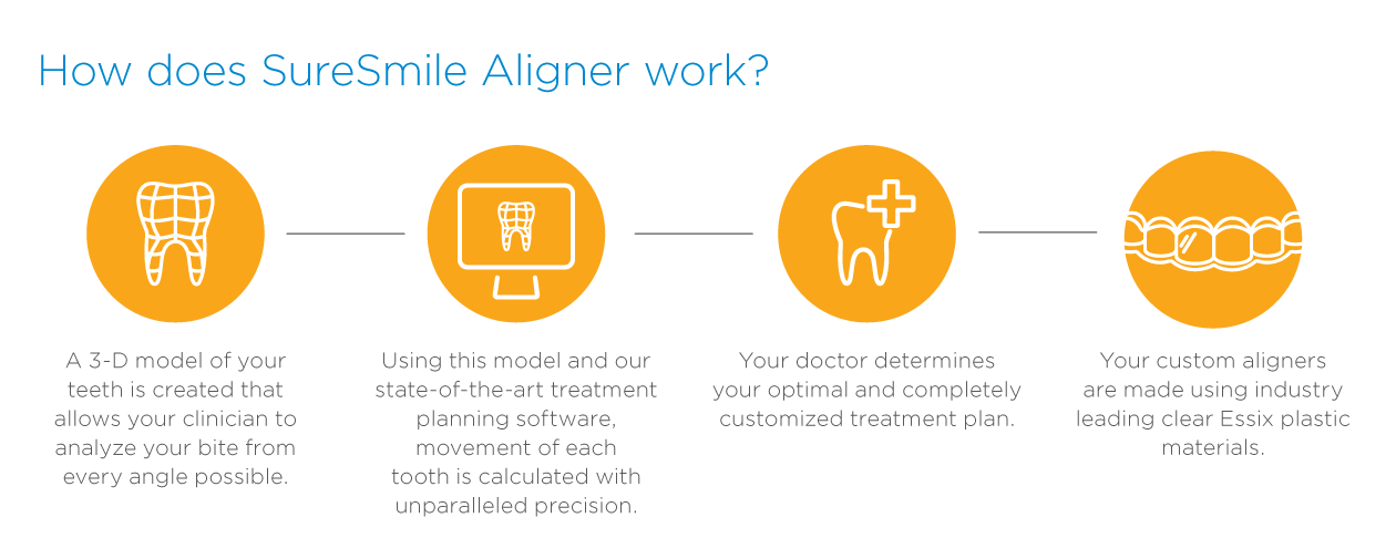 How SureSmile Aligners Work to Straighten Teeth